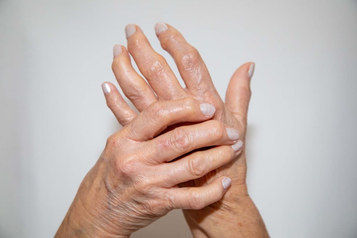 Arthritis reason:महिलाओं में आर्थराइटिस की वजह