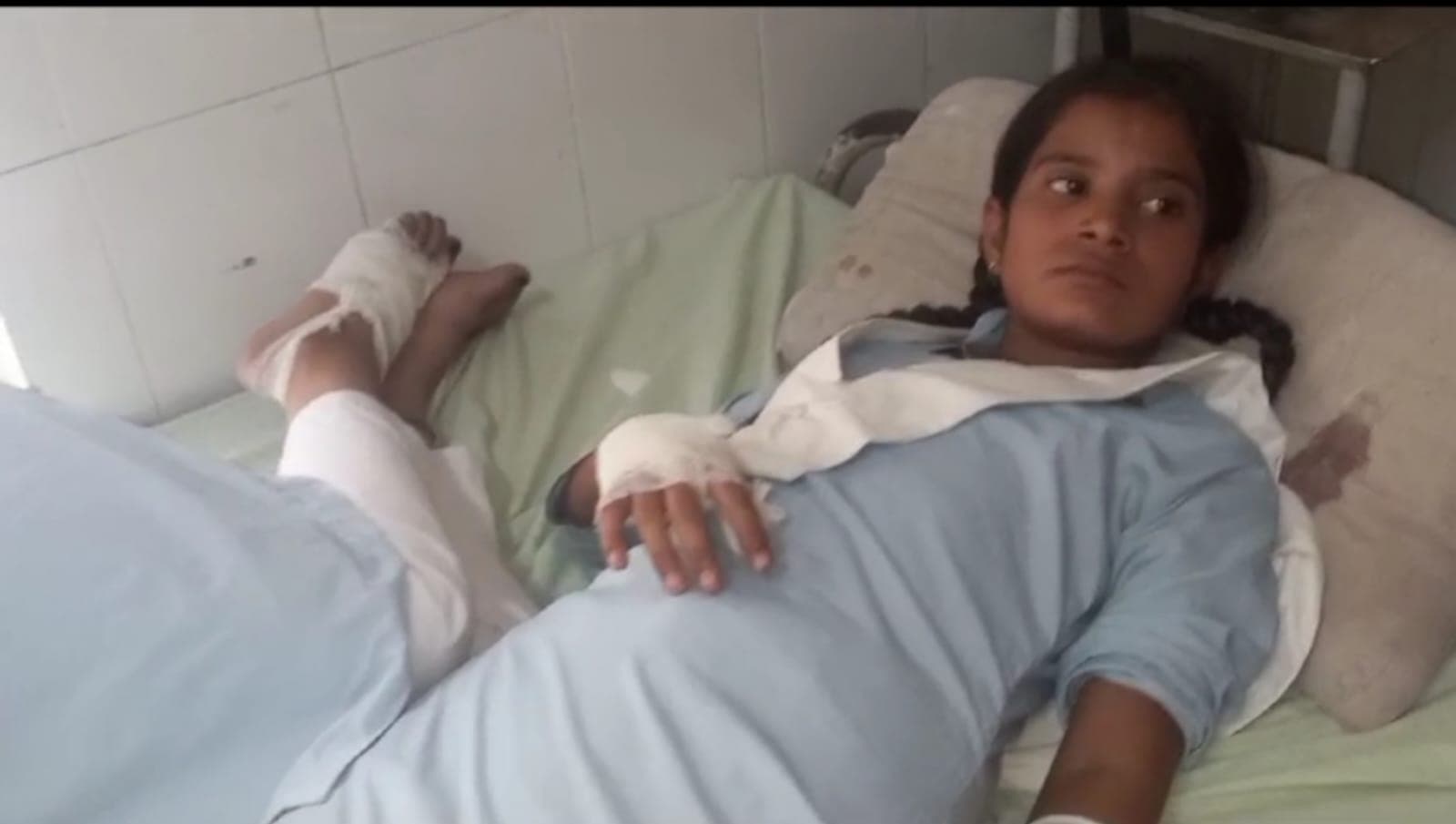 अलीगढ़: कॉलेज में लगे विद्युत पोल में आया करंट, चपेट में आने से झुलसी 5 छात्राएं