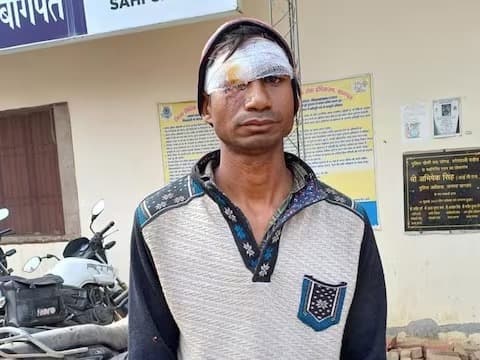 UP News: पति ने नहीं दिया गाने सुनने के लिए मोबाइल, तो पत्नी ने आंख में घोंप दी कैंची, जानें पूरा मामला