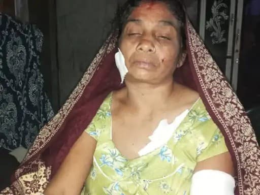 Lucknow News: बेरहम पति ने पत्नी को बीच सड़क पर 12 सेकेंड में 17 बार कैंची से गोदा, आरोपी गिरफ्तार