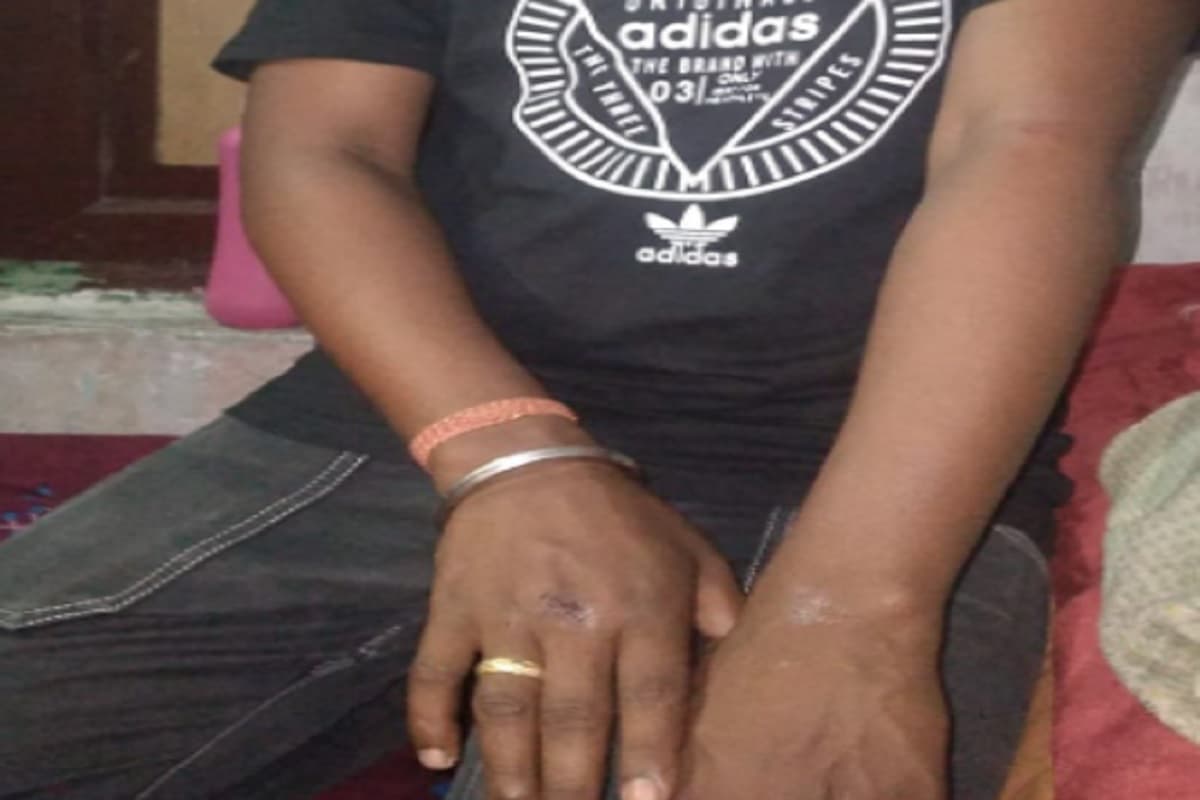 जमशेदपुर : गोलमुरी पार्क में युवकों का हंगामा व पथराव, महिलाओं से की मारपीट