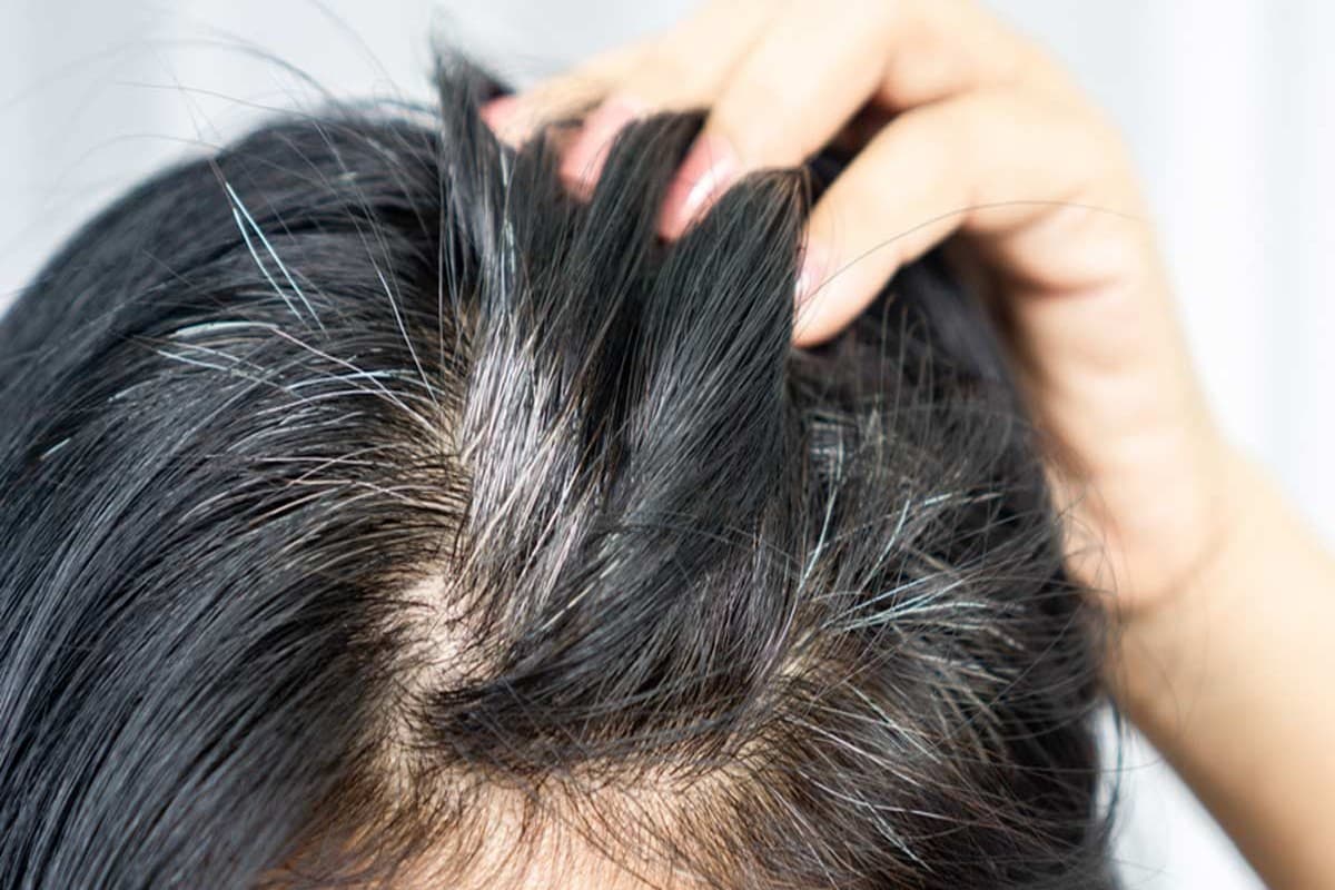 Home Remedies For White Hair: सफेद बालों को नेचुरल तरीके से कैसे करें काला, यहां जानें घरेलू उपाय