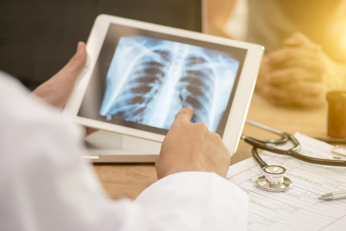 World Tuberculosis Day: आज है वर्ल्ड ट्यूबरक्लोसिस डे, जागरूकता से टीबी को दें मात