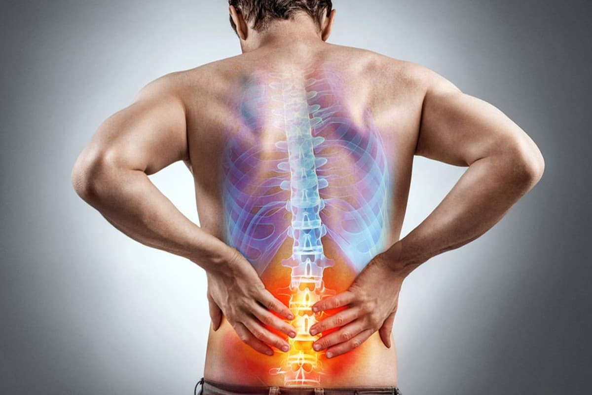 Back pain: पीठ दर्द के घरेलू इलाज और बचाव के उपाय