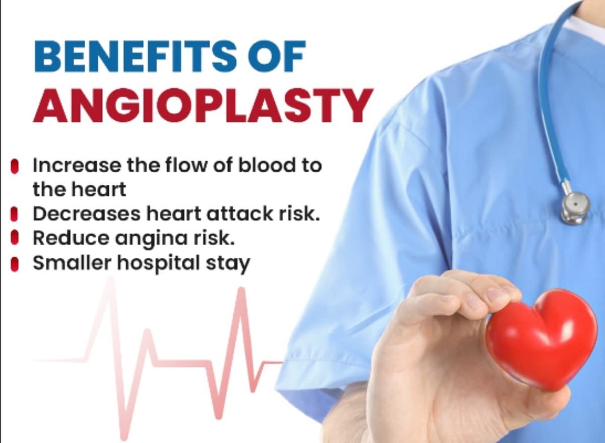 Angioplasty :धमनी रोग से पीड़ित मरीजों की भी होती है एंजियोप्लास्टी, जानें क्या कहते हैं डाॅक्टर