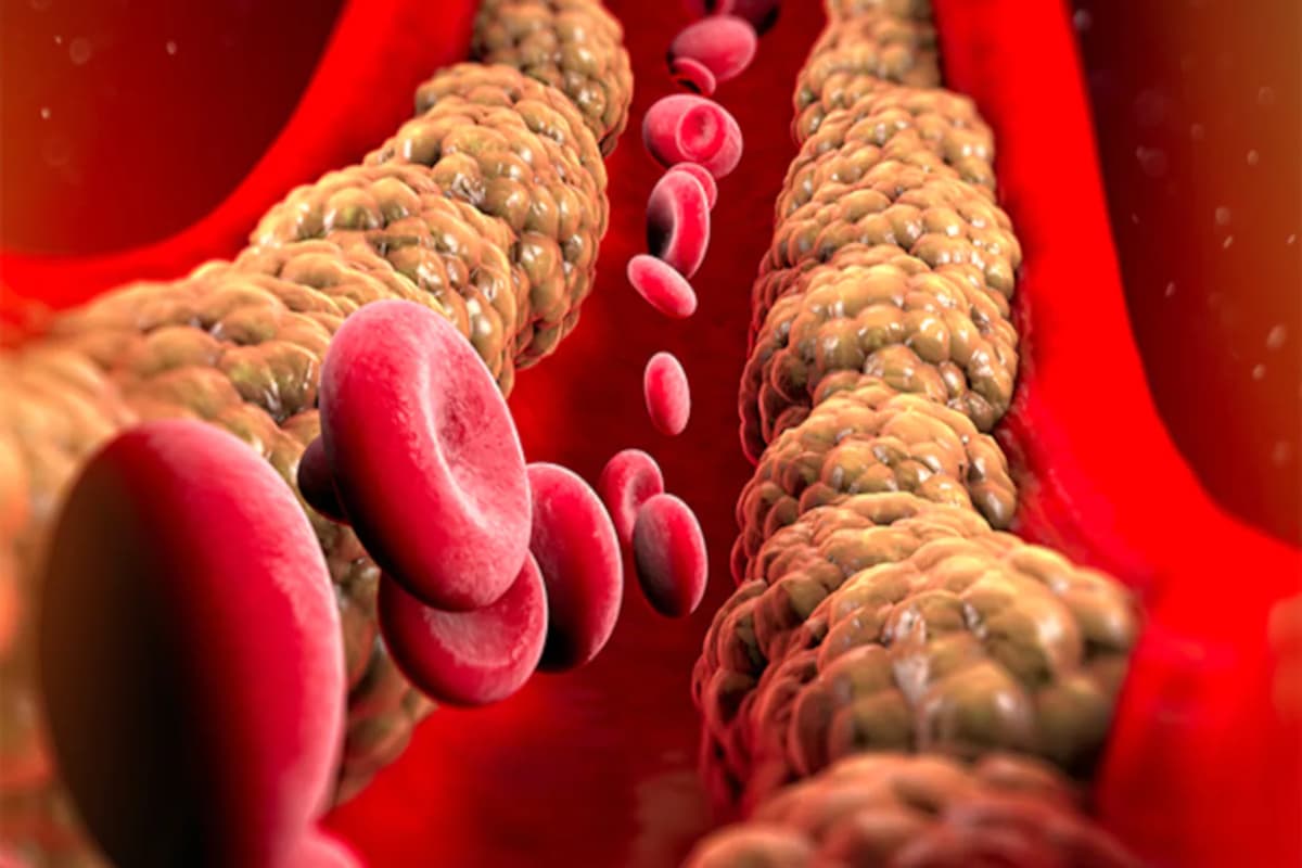 Morning Habits For Cholesterol: बढ़ते कोलेस्ट्रॉल लेवल से निजात पाना चाहते हैं, एक महीने तक सुबह में करें ये काम