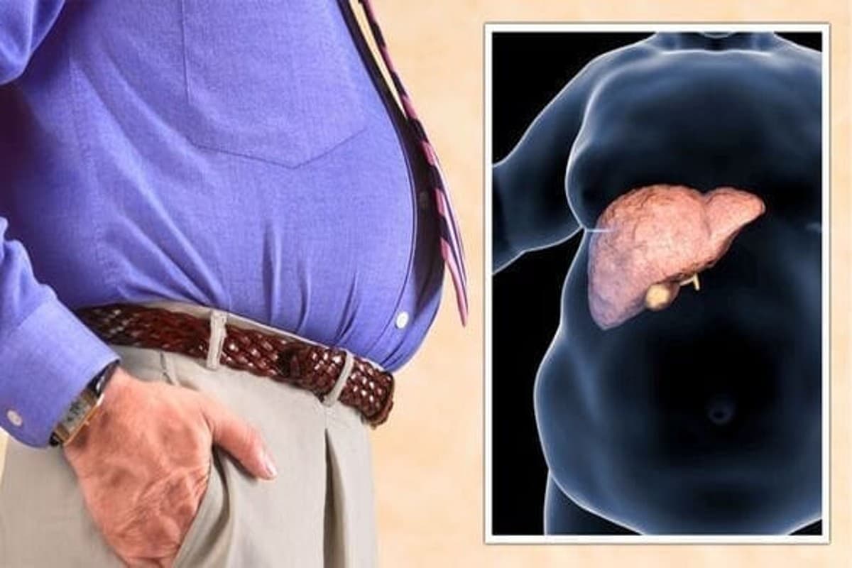 Health Tips: फैटी लिवर की समस्या से हैं परेशान? इन चीजों को करें डायट में शामिल