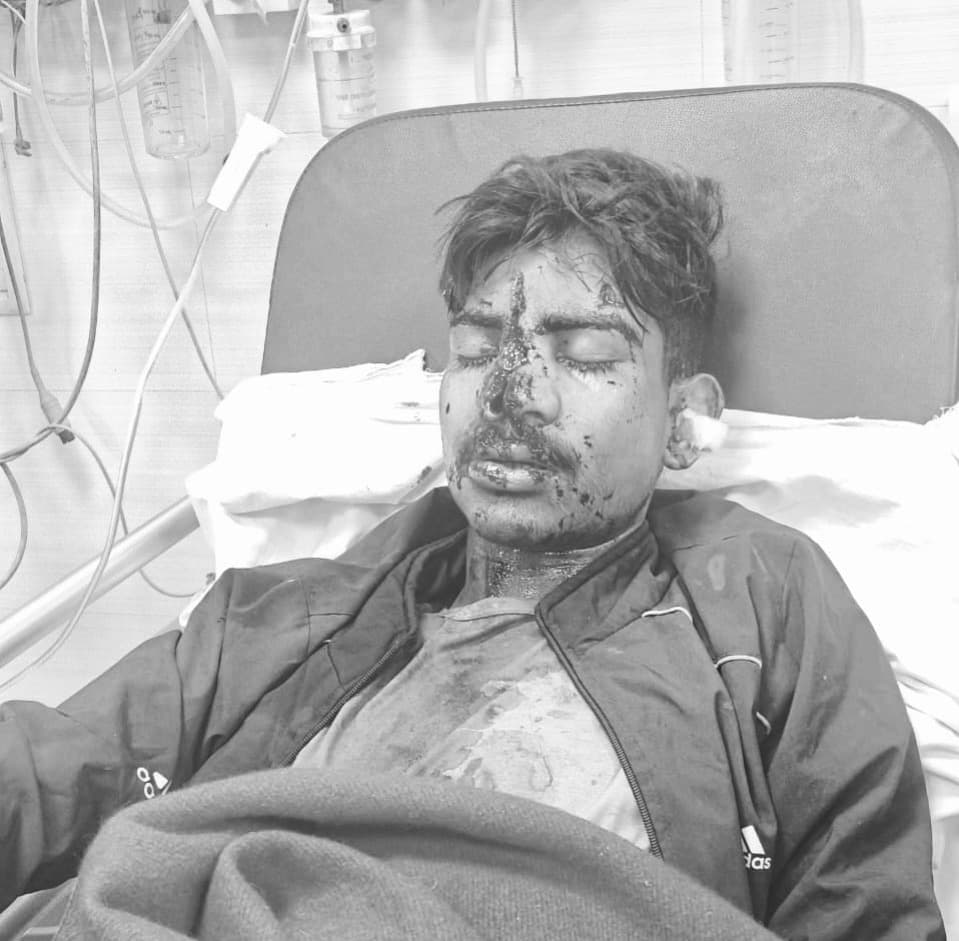 गोलमुरी : डिलेवरी ब्वॉय पर हमला कर मोबाइल- पैसे की लूट, गंभीर