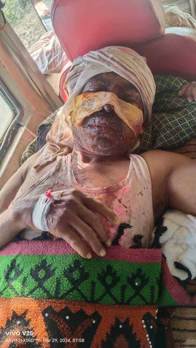 घर में सो रहे किसान के चेहरे पर मारी गोली, हालत नाजुक