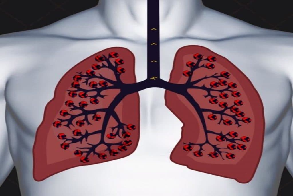lungs