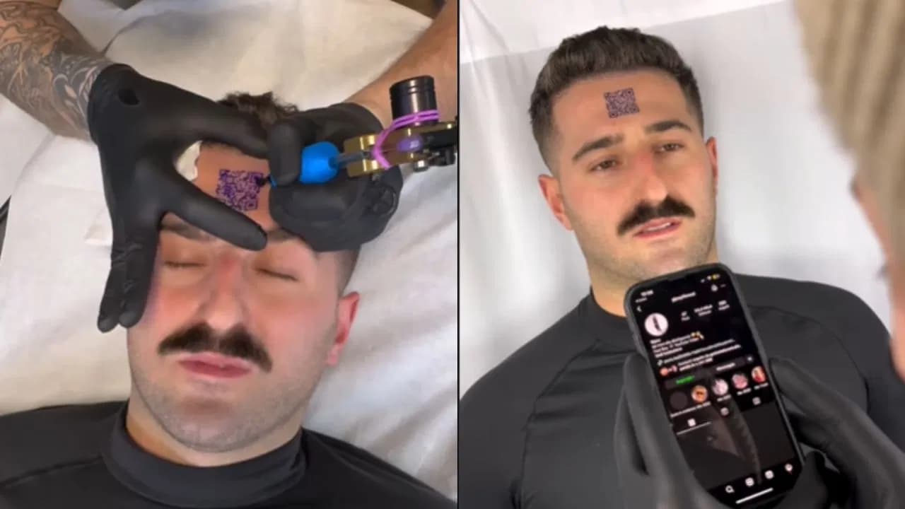 Video Viral: इंस्टाग्राम फॉलोअर्स बढ़ाने का भूत ऐसा चढ़ा, बंदे ने माथे पर गुदवा लिया QR Code