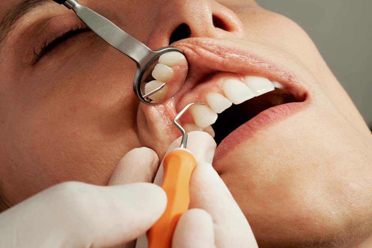 National Dentist Day: क्या है नेशनल डेंटिस्ट डे, कब से हुई थी शुरुआत, जानें