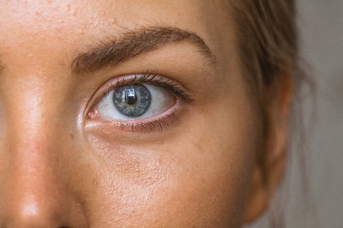Summer Skin Care Tips: सनबर्न से होने वाले नुकसान से खुद को रखें सुरक्षित, जानें क्या है तरीका