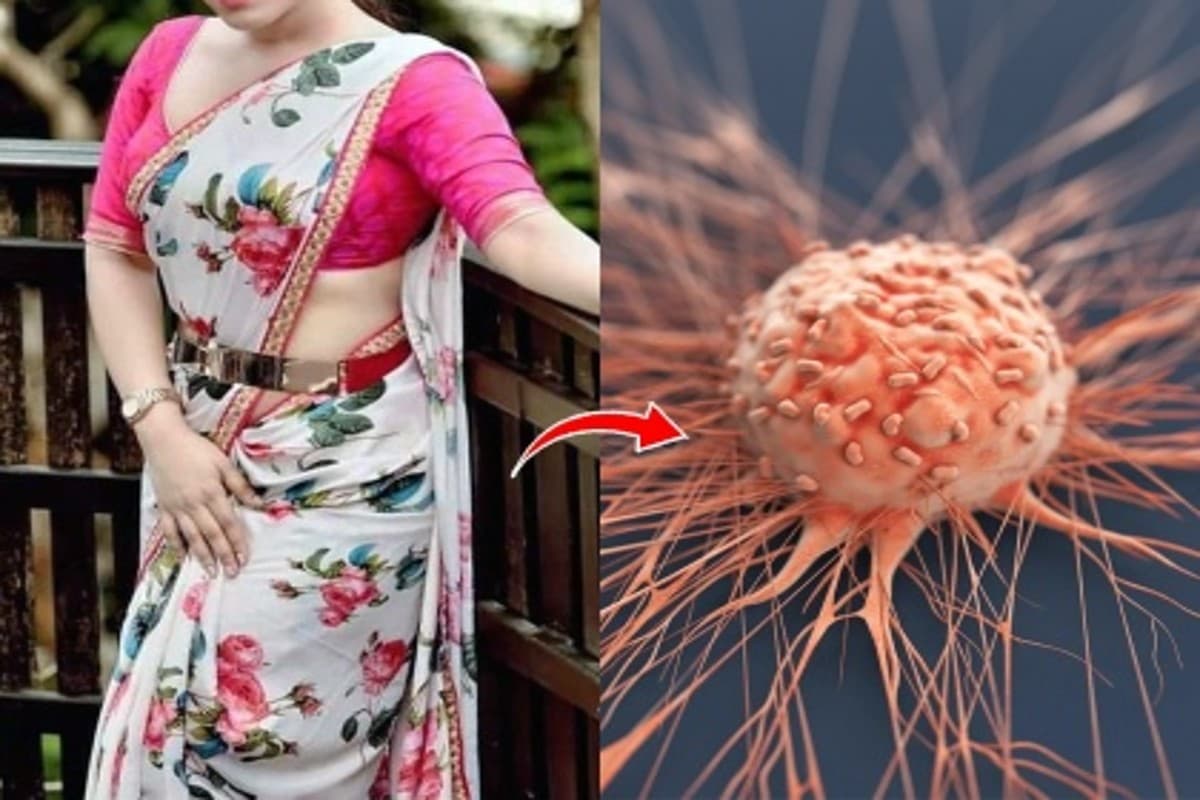 Saree Cancer: क्या है साड़ी कैंसर? जानिए कारण