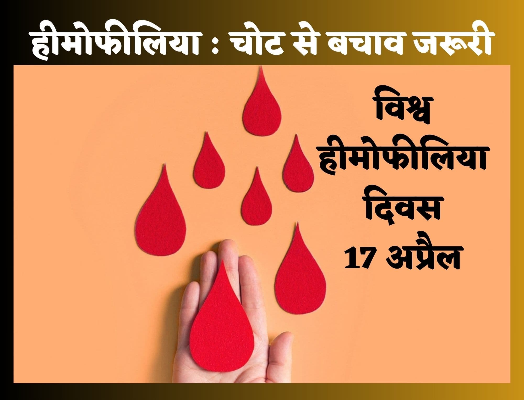 World Hemophilia Day : क्या है हीमोफीलिया, सिर्फ पुरुषों को ही होती है यह बीमारी, क्यों चोट से बचाव है जरूरी