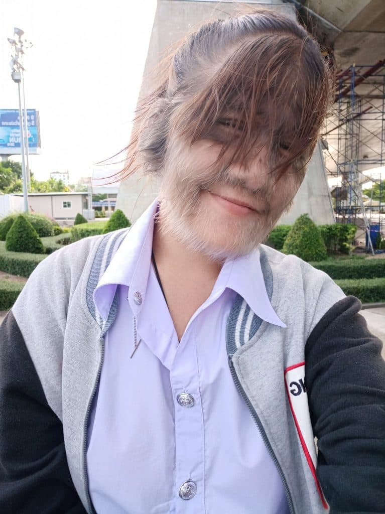 Worlds Hairiest Girl news in hindi