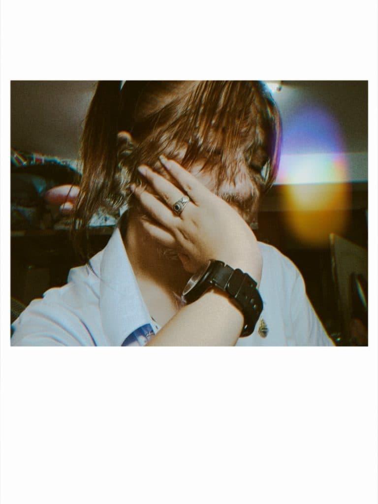 Worlds Hairiest Girl of thailand