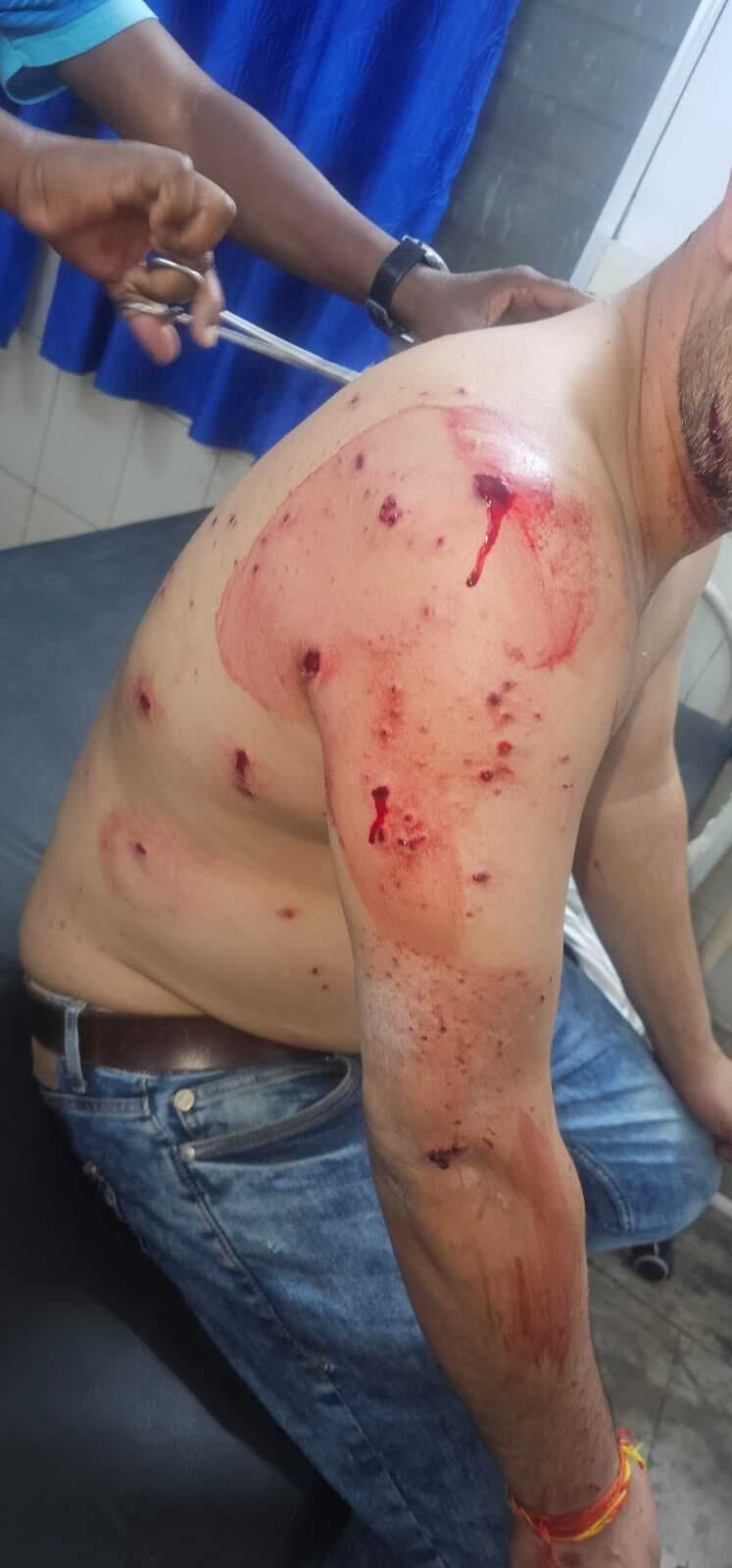 कारोबारी और झामुमो नेता पर बम से हमला