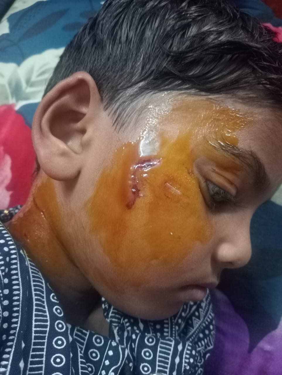 जीएम कॉलोनी ढोरी में बंदरों के आतंक से लोग परेशान