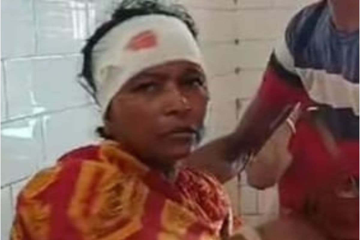 Lok Sabha Election 2024 : स्वरूपनगर में तृणमूल-भाजपा समर्थकों में मारपीट, चार भाजपा समर्थक घायल, महिला का सिर फटा