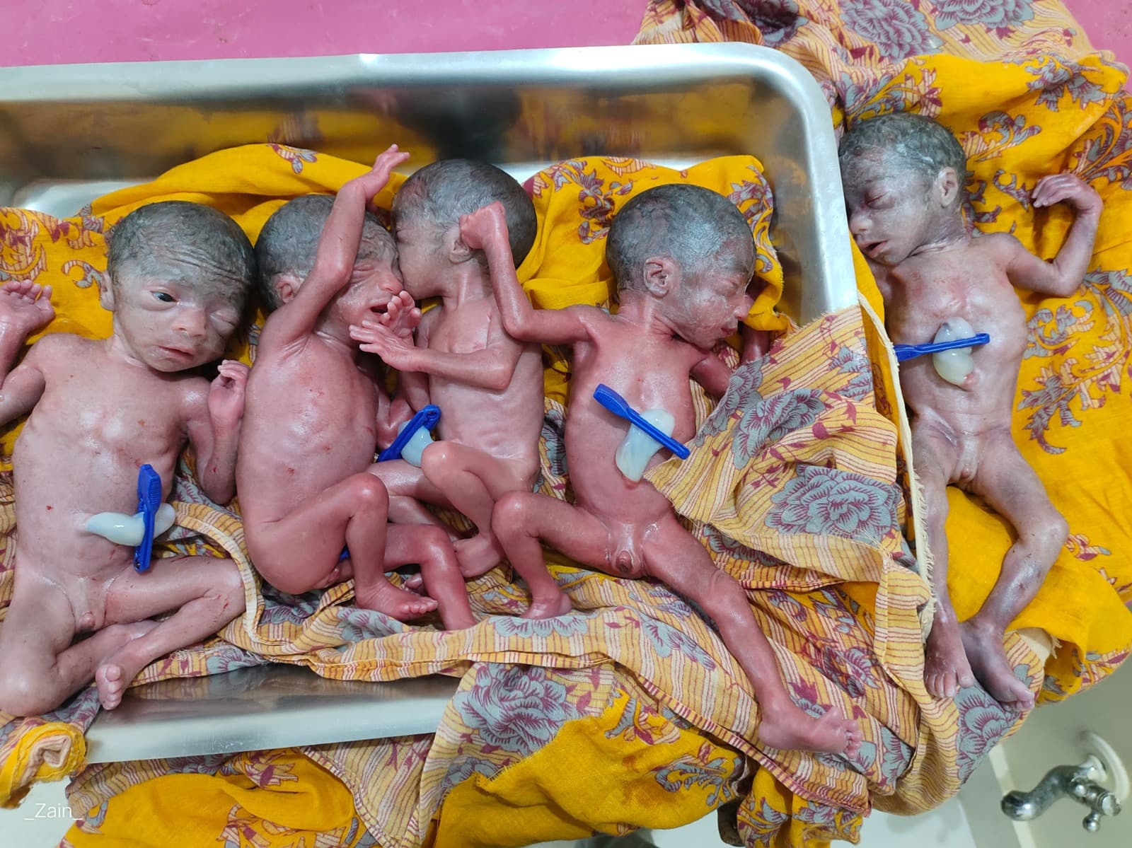 बिहार में महिला ने एकसाथ 5 बच्चियों को दिया जन्म, देखने के लिए अस्पताल में उमड़ी भीड़