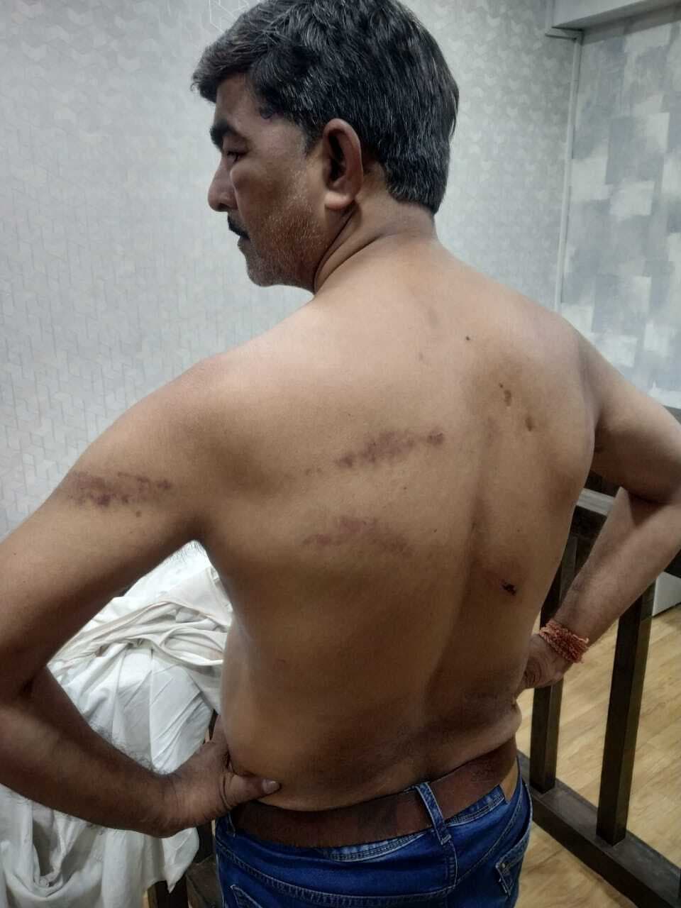 रंगदारी नहीं दी, तो मारपीट कर किया घायल