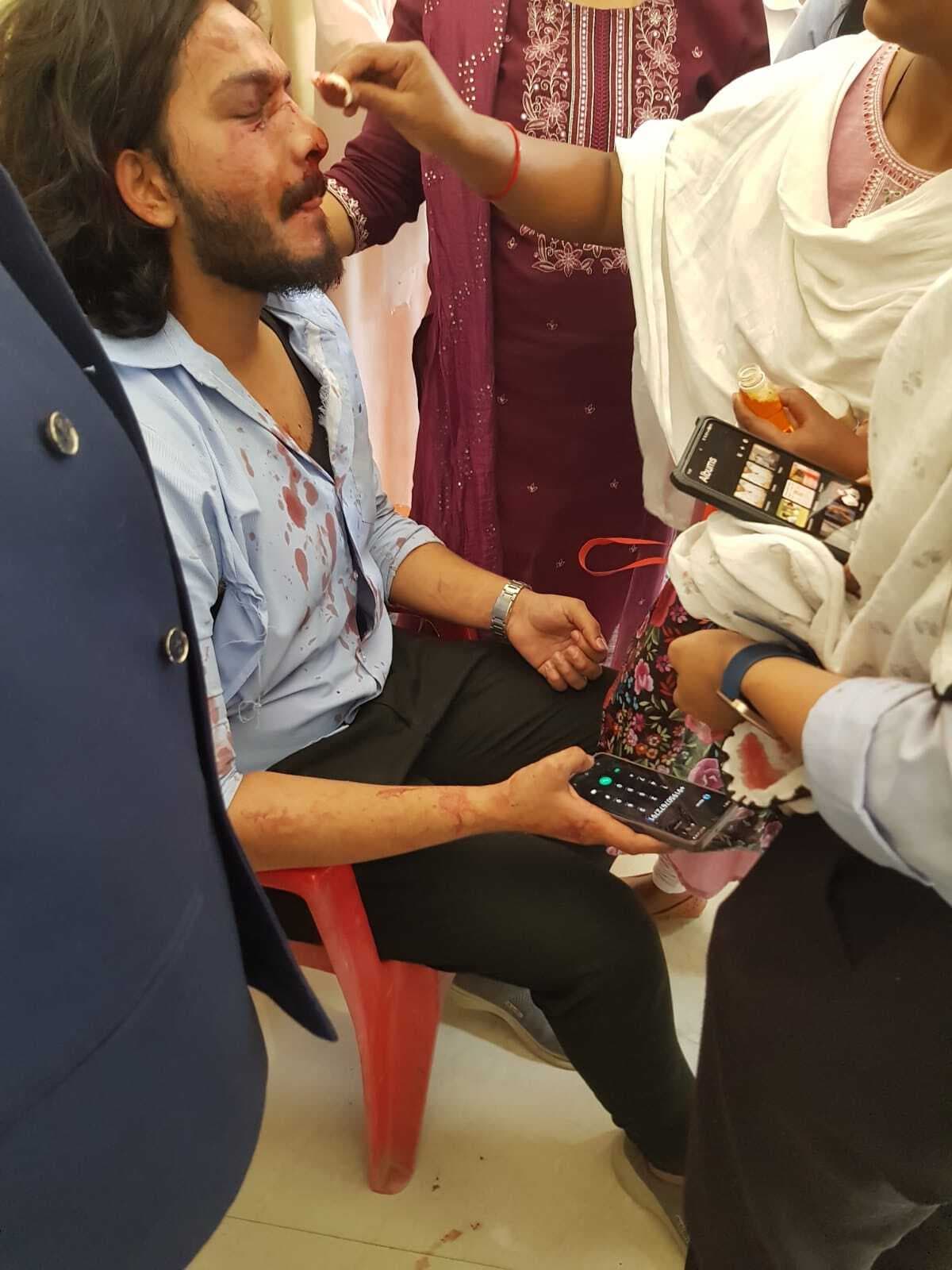 डीएसपीएमयू : छात्रों के बीच जम कर हुई मारपीट, एक का माथा फटा, तीन टांके लगे