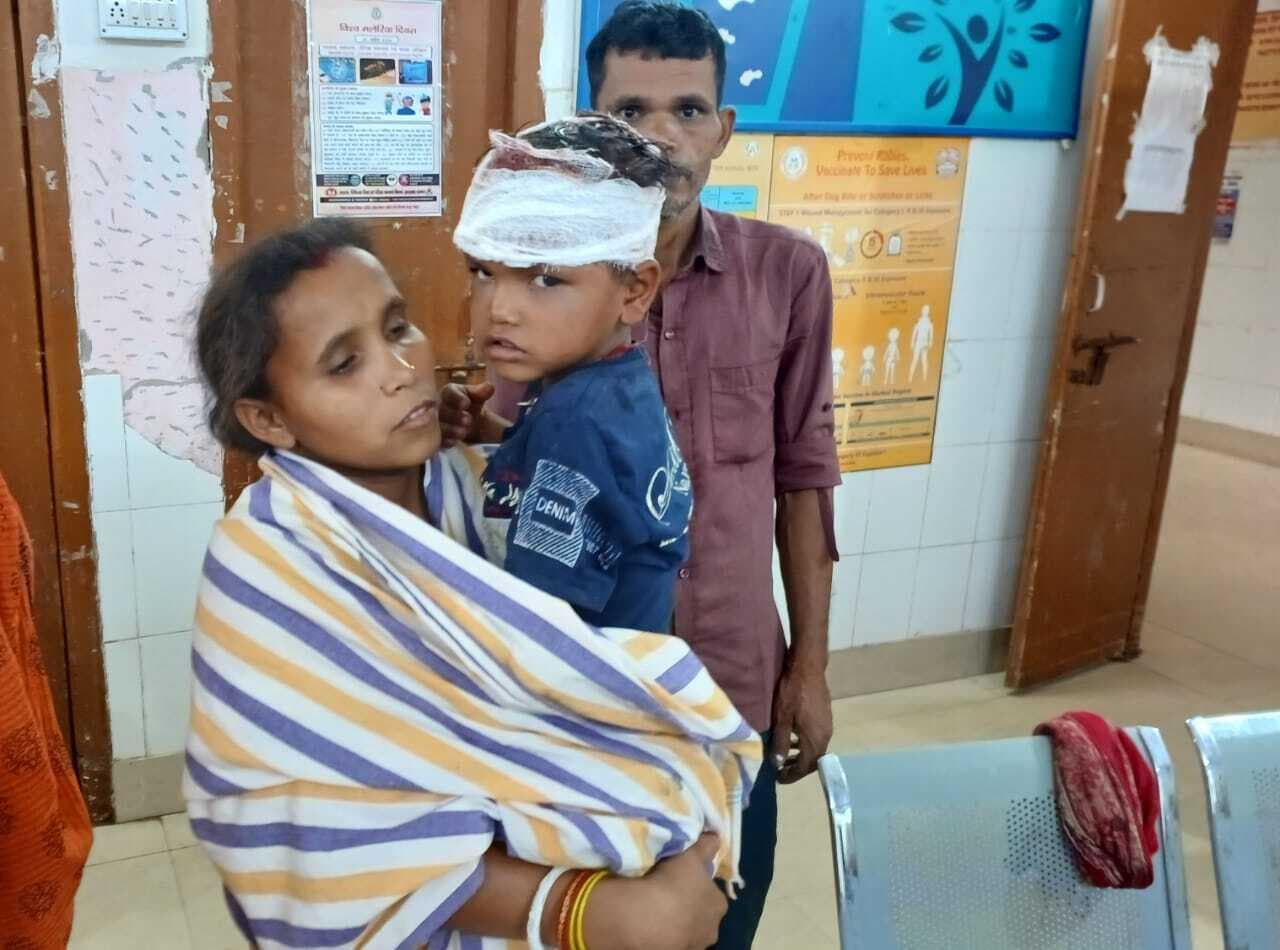 छत से गिरा पांच वर्षीय बालक, सिर में लगी गंभीर चोट