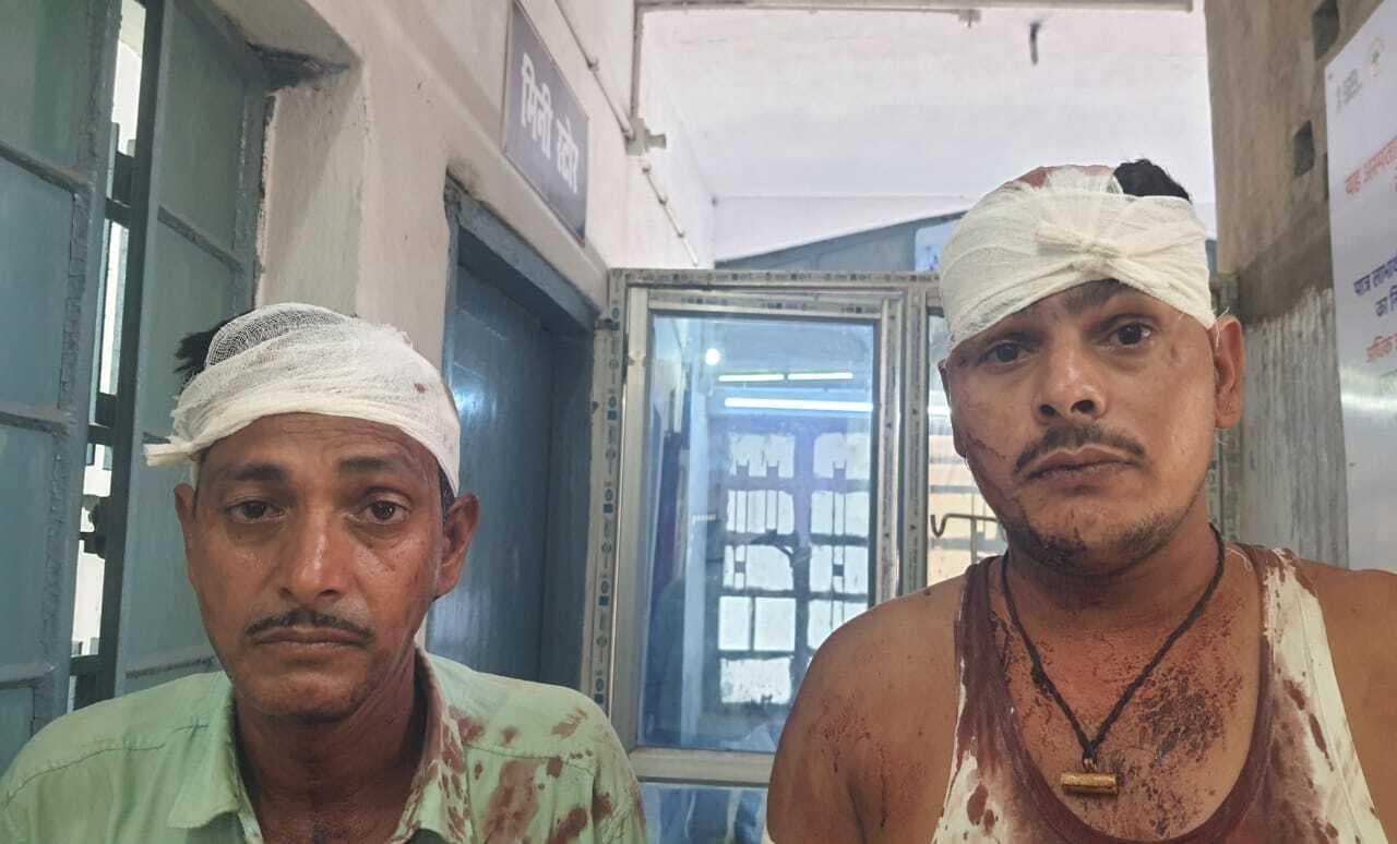 टहकवानी में जमीन विवाद को लेकर चचेरे भाईयों में हुई मारपीट, थाना में रिपोर्ट दर्ज