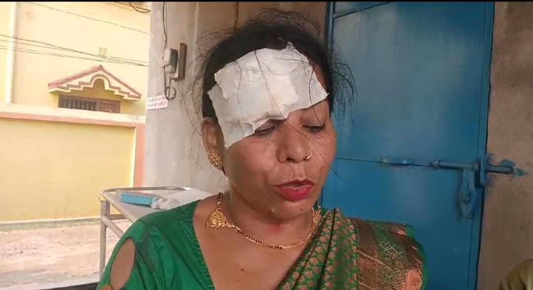 कार व ऑटो में टक्कर, कुल्टी के पांच घायल