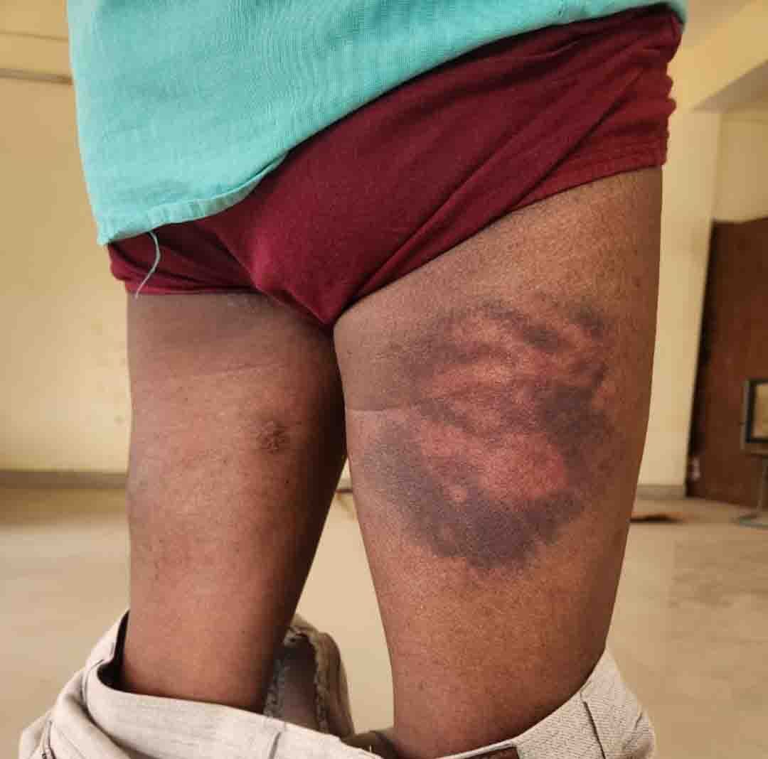 कांग्रेस नेता का आरोप, हाजत में निर्वस्त्र कर उन्हें पीटा गया