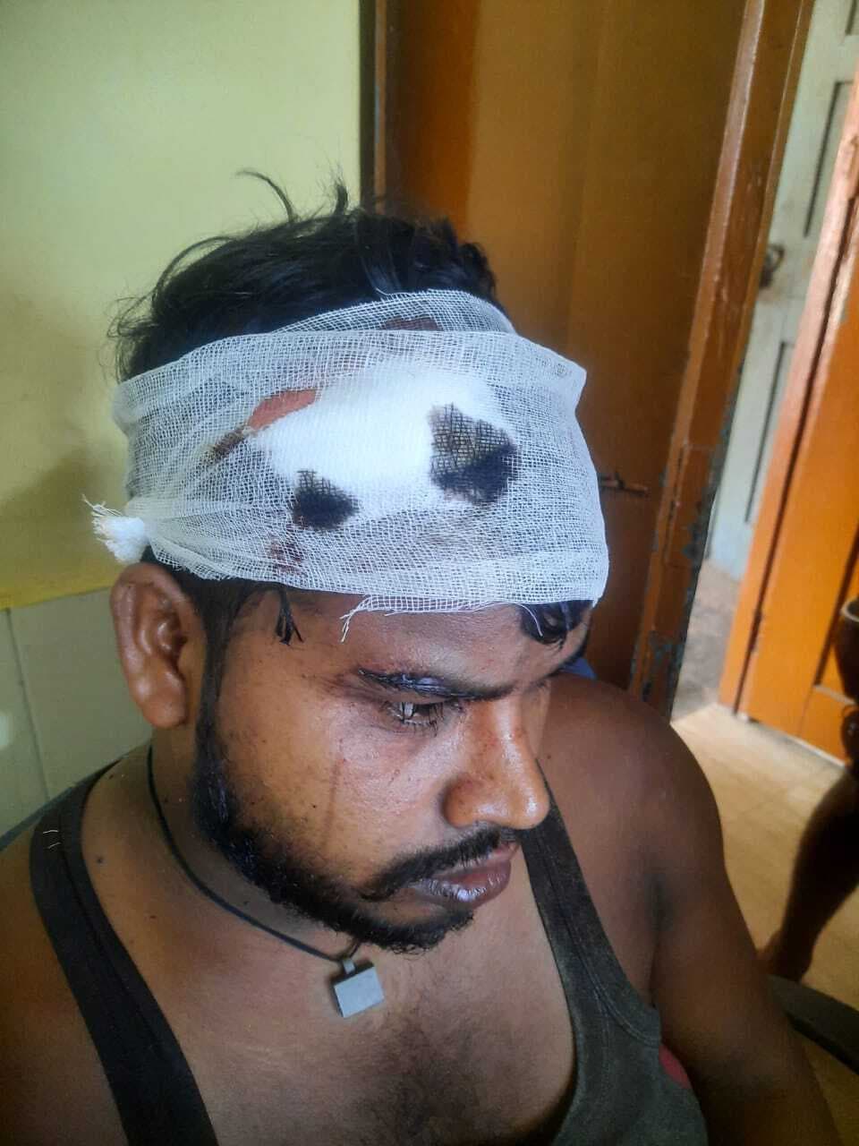 बड़े भाई ने छोटे पर किया भुजाली से हमला, हालत गंभीर