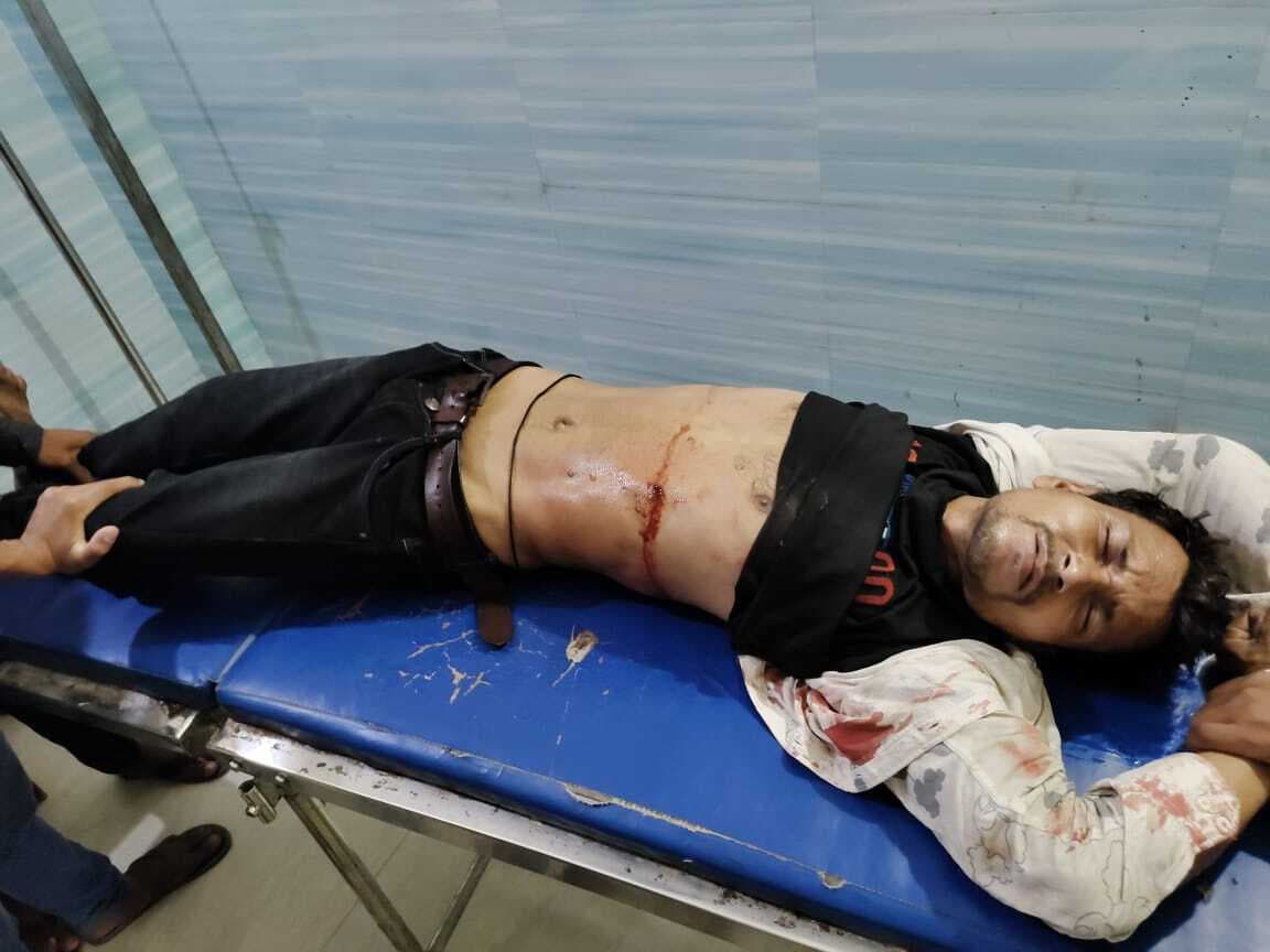 पाॅल्ट्री फार्म के कर्मी को मारी गोली, गंभीर स्थिति में रेफर