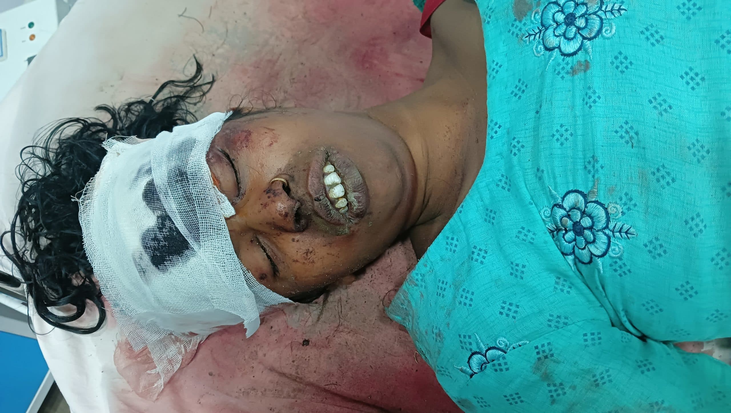 निरसा : जंगल में घायल हालत में मिली महिला