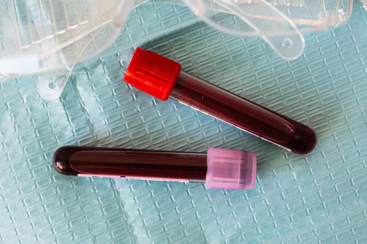 आखिर क्यों होता है खून का रंग लाल, कारण जान चकरा जाएगा दिमाग