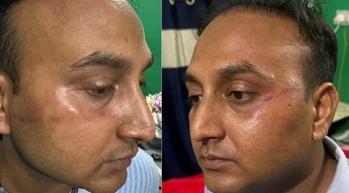 Rohtas : डॉक्टर की पिटाई मामले में बड़ा एक्शन, एएसआइ को थाने से हटाया