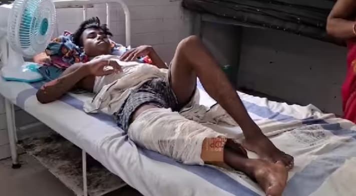 SKMCH: टूटे पैर में सर्जरी कर प्लेट की जगह डॉक्टर ने लगा दिया कार्टन, मामले की जांच शुरू