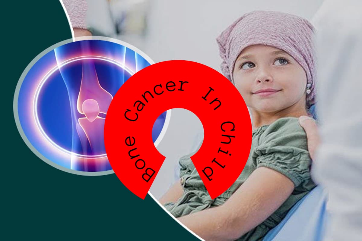 Bone Cancer: बच्चों को होता है हड्डियों के कैंसर का खतरा, ये होते हैं लक्षण