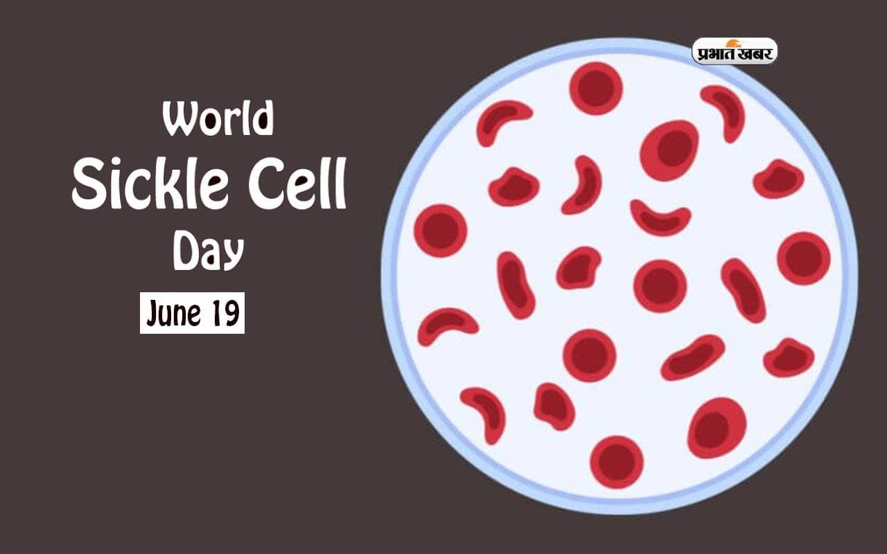 World Sickle Cell Day 2024 आज पर जानें महत्व और थीम