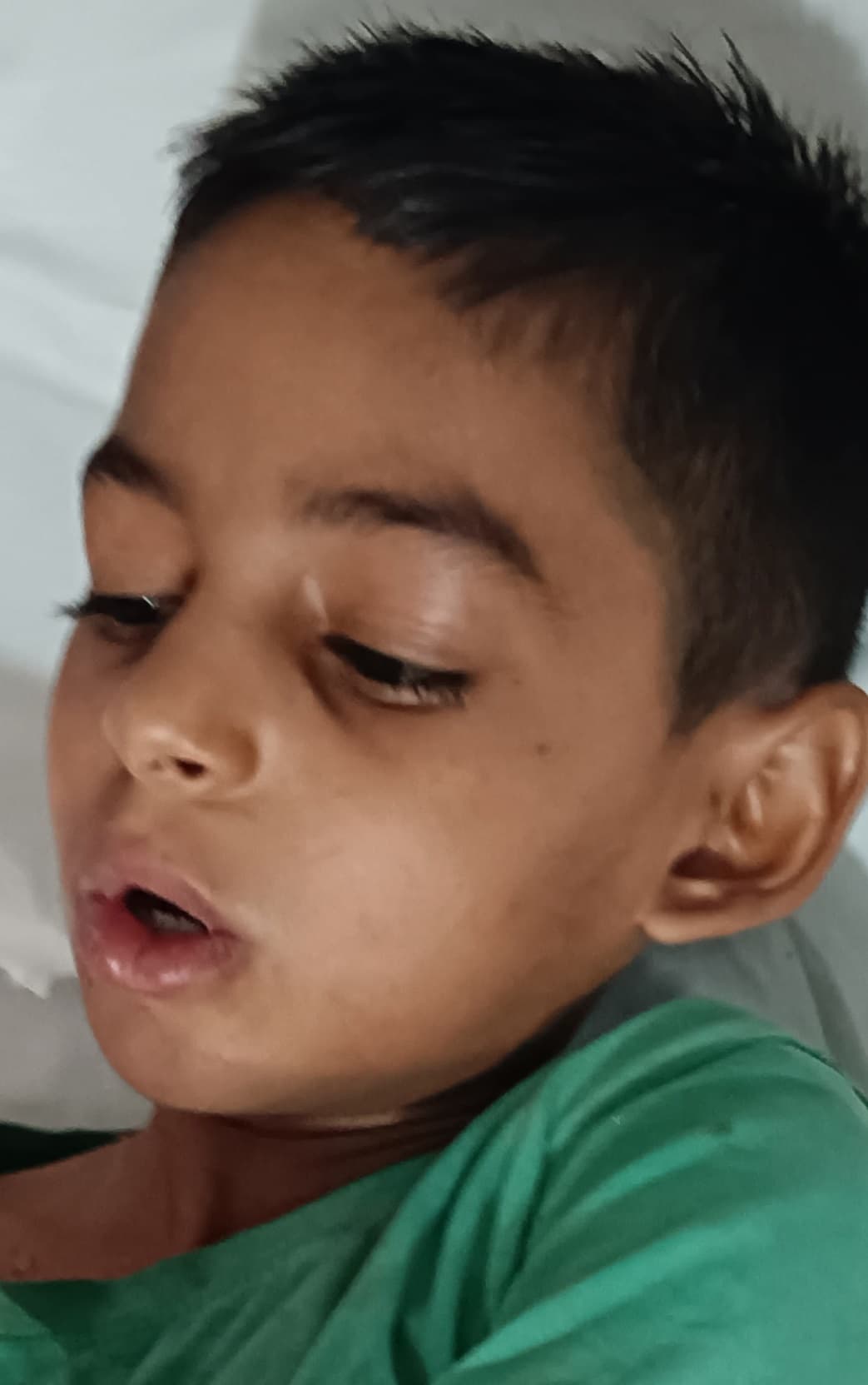 बरही में 300 लोग विषाक्त भोजन खाने से हुए बीमार