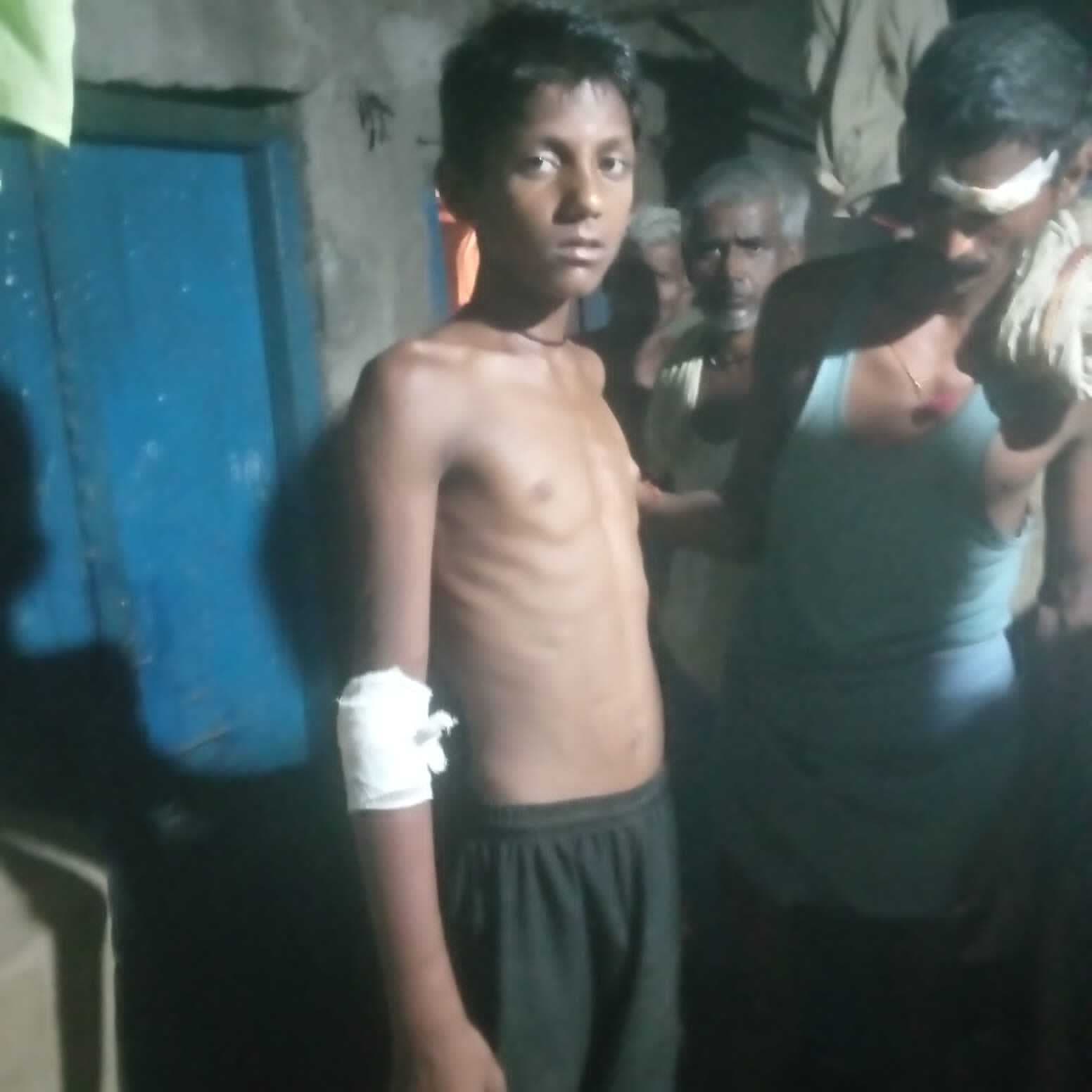 धनरूआ में विवाद में किशोर को मारी गोली