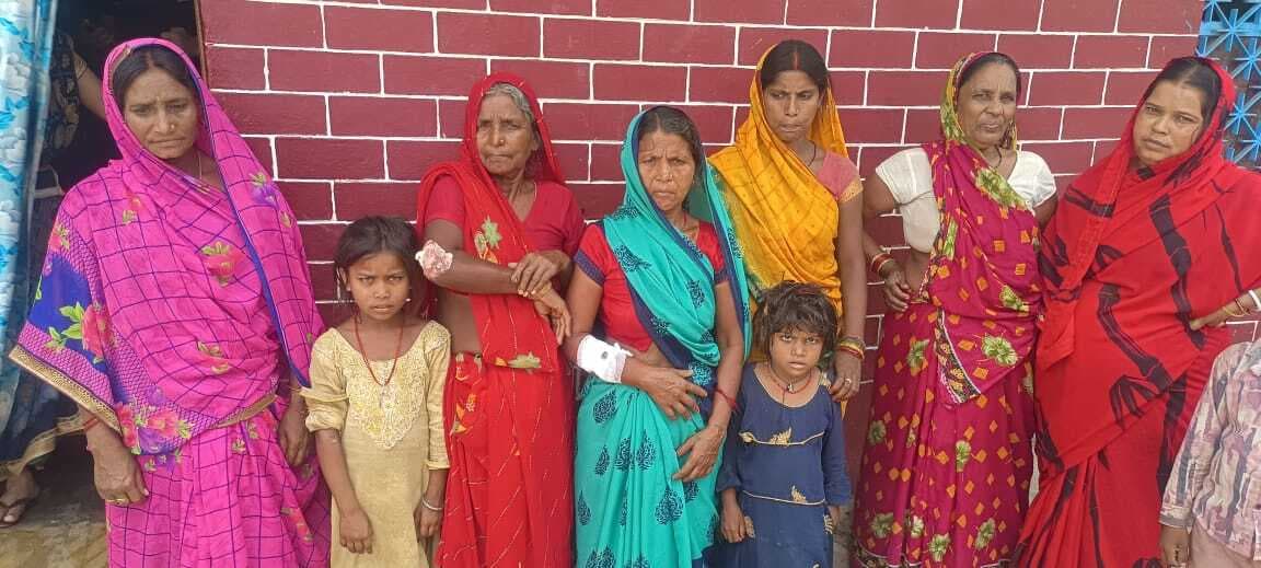 एक दर्जन लोगों को बंदर ने काटा , आतंक से ग्रामीण सहमे