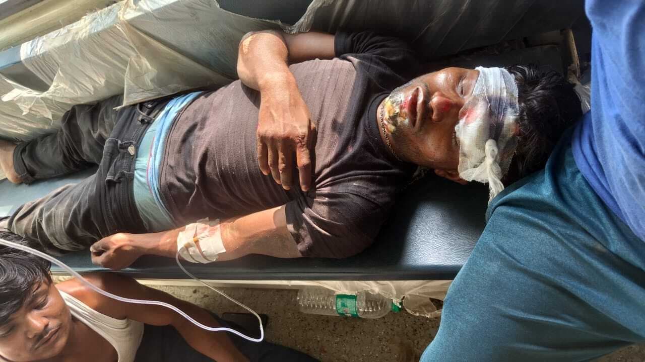 स्कार्पियो व बाइक की टक्कर, पिता-पुत्र जख्मी, इलाज के क्रम में पिता की हुई मौत, जिंदगी और मौत से जुझ रहा पुत्र