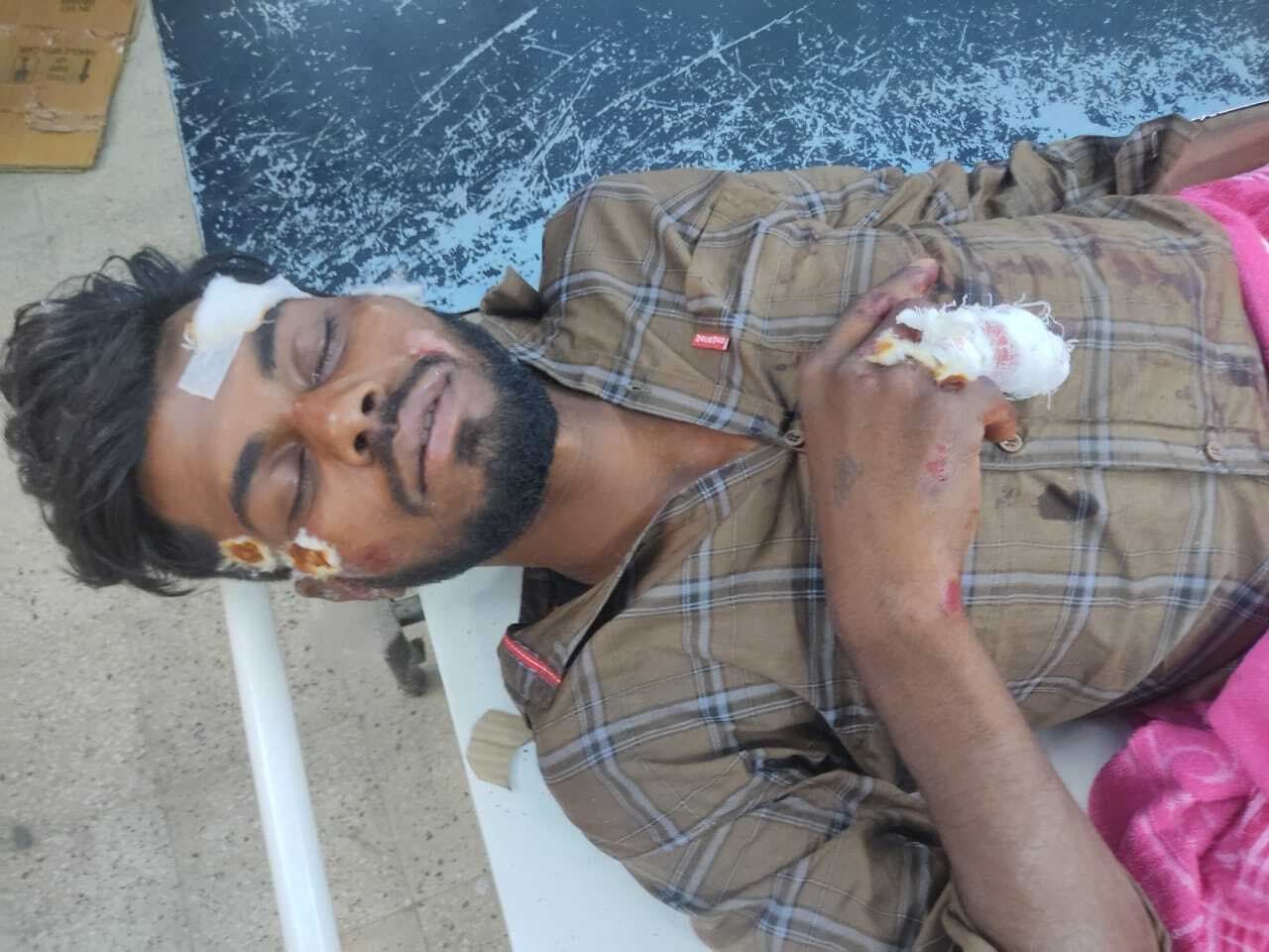 सड़क हादसे में एक युवक जख्मी