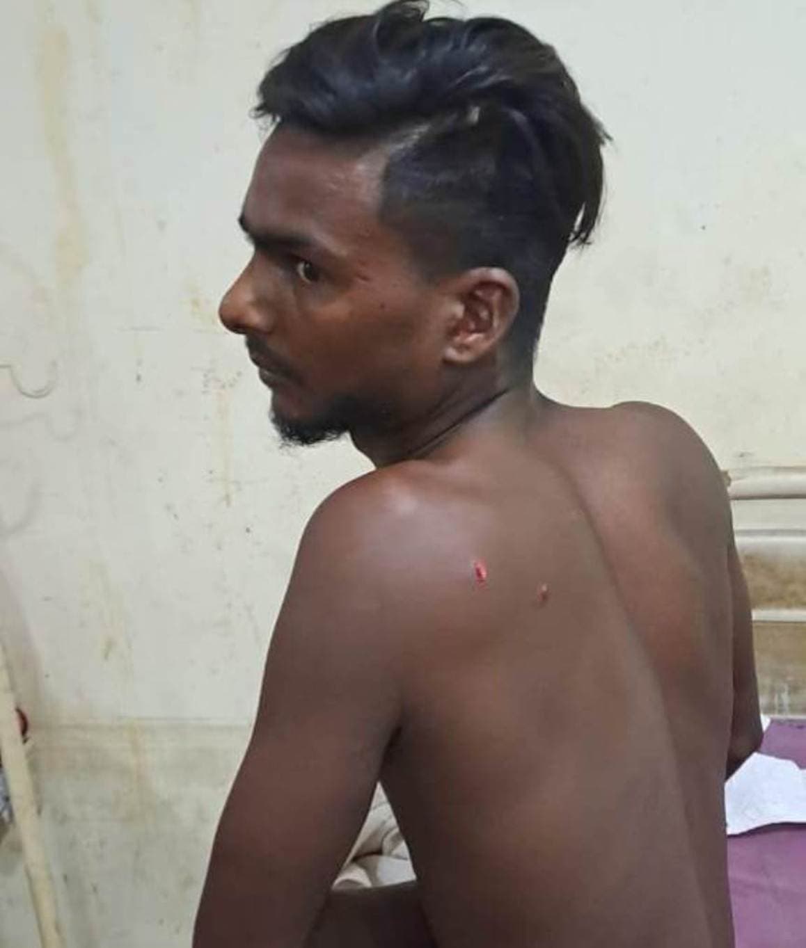 शराब की डिलिवरी करने से किया मना, तो चाकू से हमला कर युवक को किया घायल