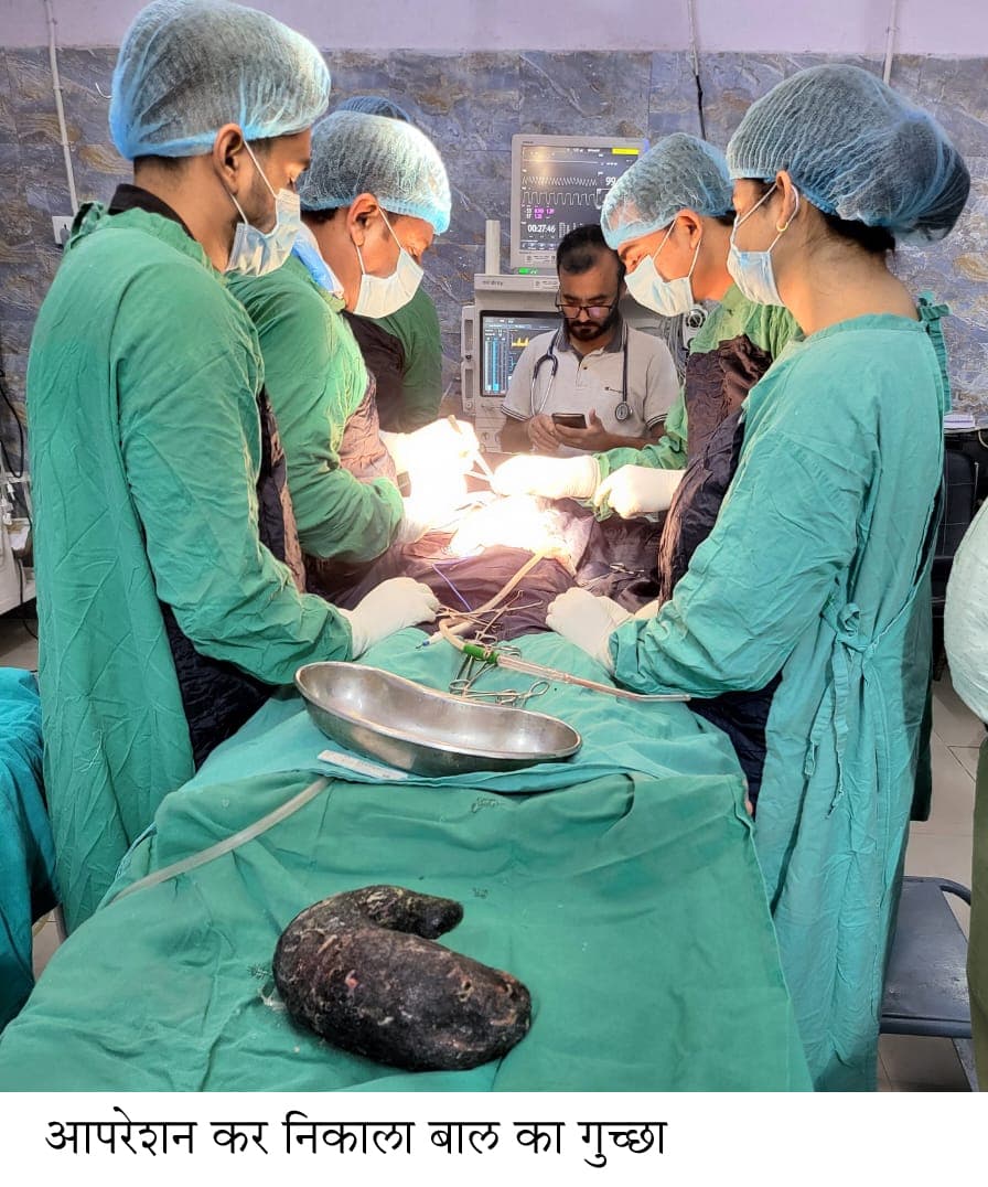 ऑपरेशन कर बच्ची के पेट से निकाला बालों का गुच्छा