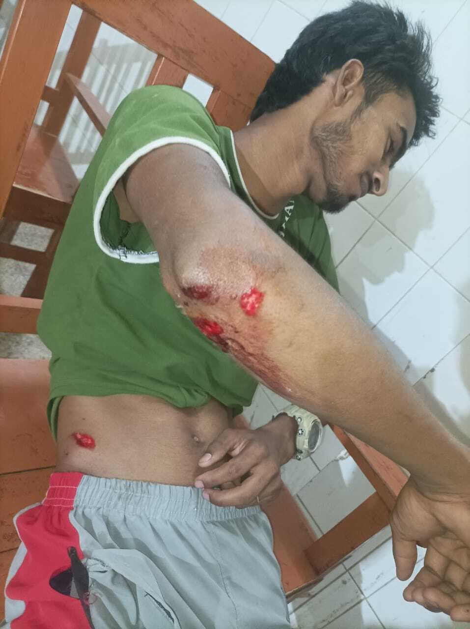 मारपीट का मामला दर्ज