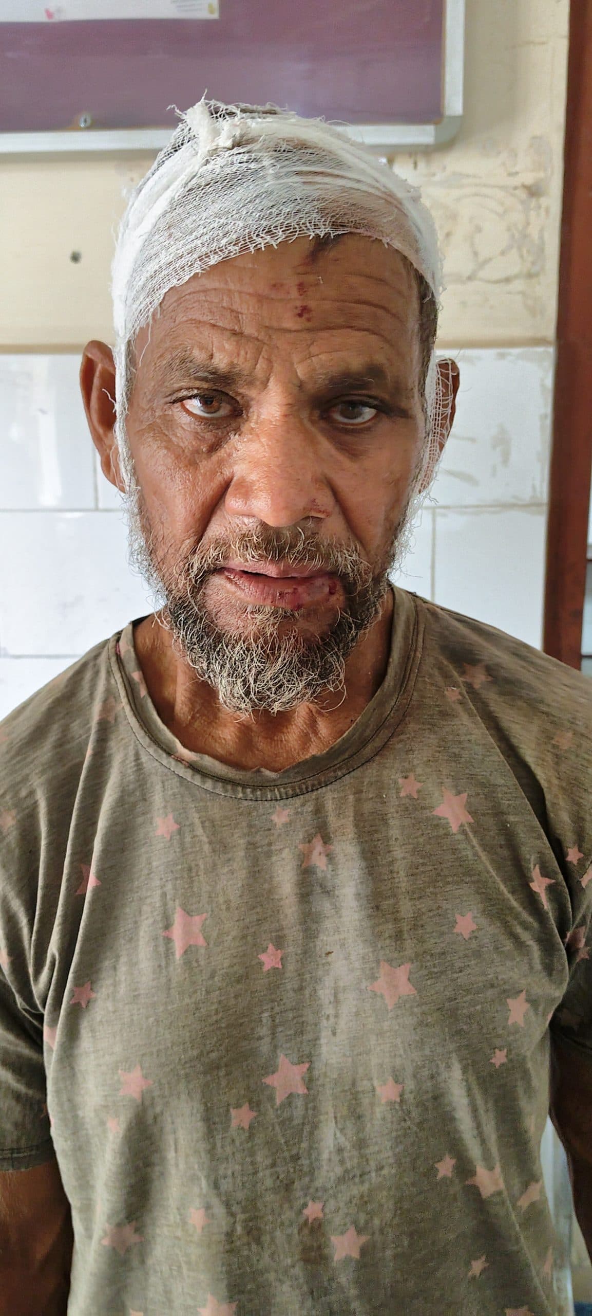 भूमि विवाद में दो पक्षों में मारपीट, दो लोग जख्मी