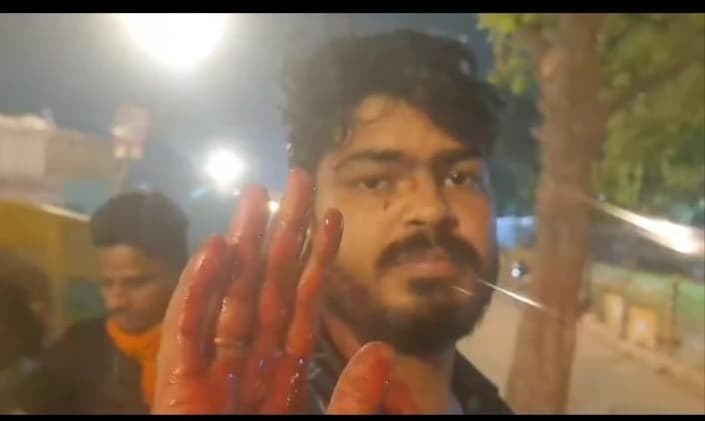 कमर से पिस्टल निकाल पहले बट से मार सिर फोड़ा, फिर कहा...पुलिस हैं यहीं ठोक देंगे...