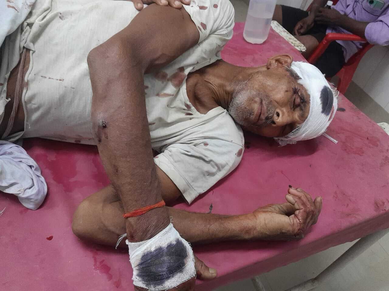 जमीन विवाद के कारण हुई हिंसक झड़प, बुजुर्ग समेत तीन जख्मी